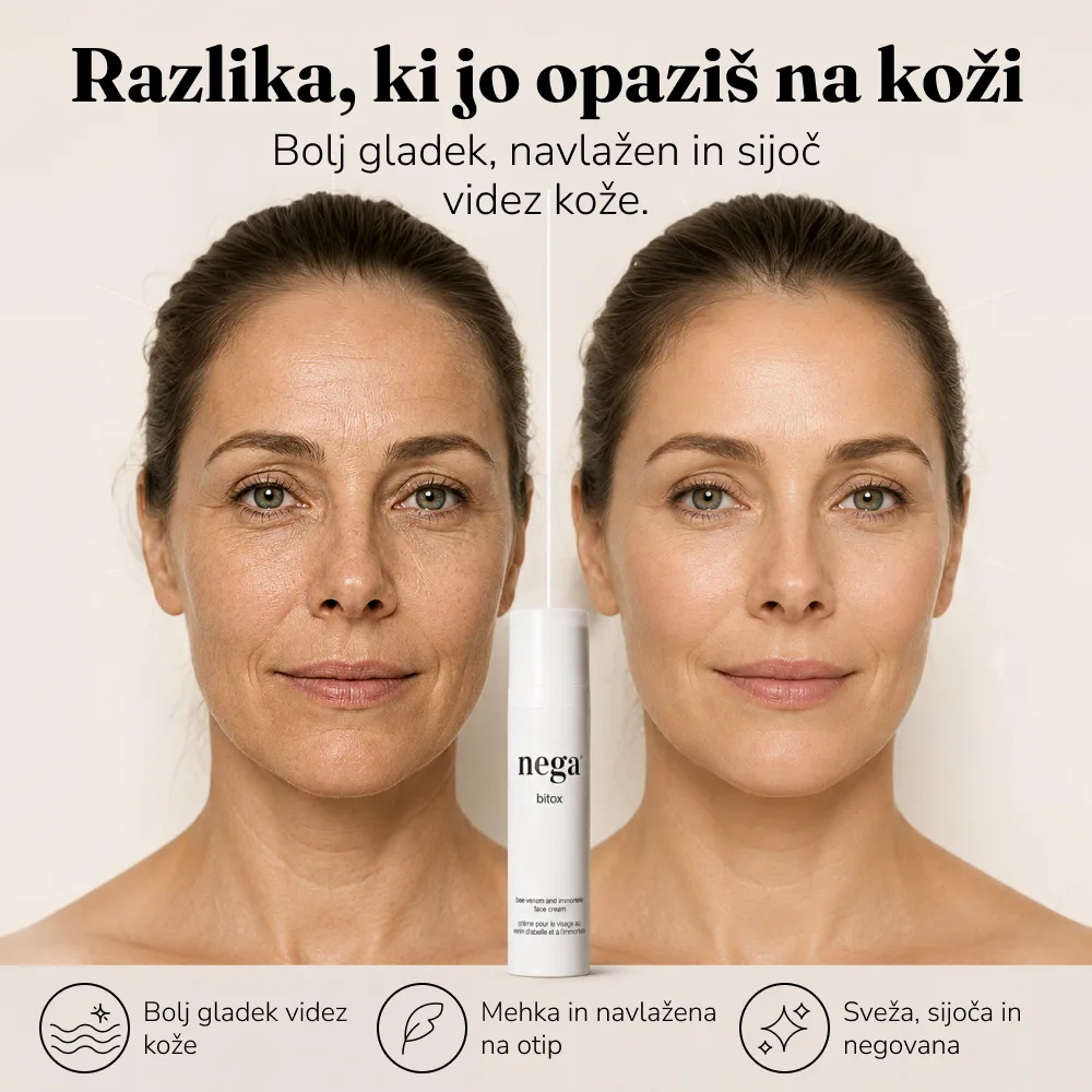 Bitox, krema s čebeljim strupom - Image 6